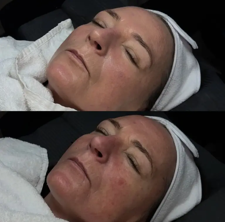 Gesichtsbehandlung Studio Gloweria – Dein Kosmetikstudio in Donau-Ries